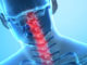 Eric Hewko - Back Injury Attorney